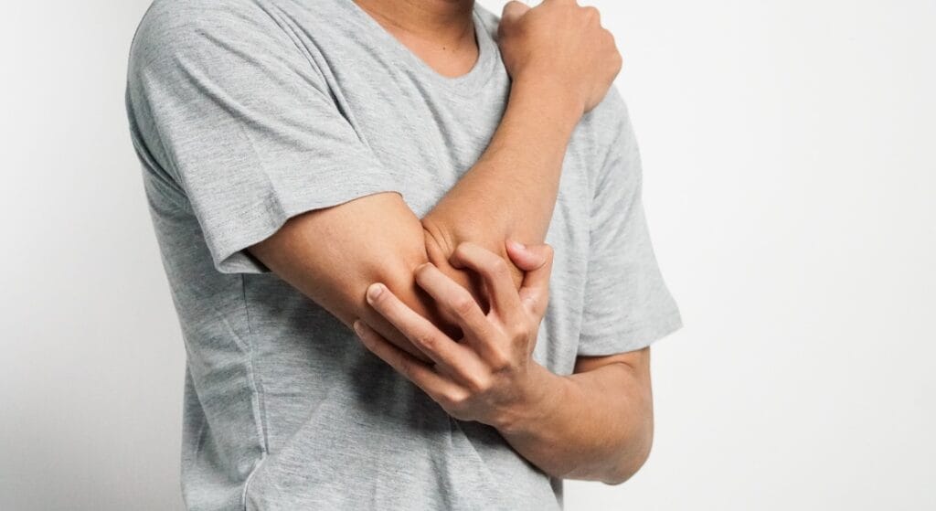 nguyên nhân tràn dịch khớp khuỷu tay