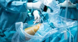 nội soi khớp gối