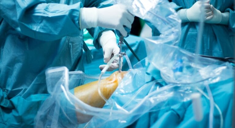 nội soi khớp gối