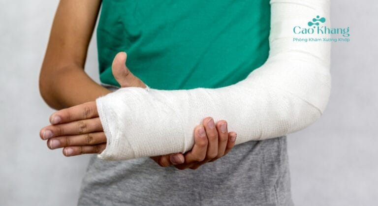 sau khi bó bột tay bị sưng