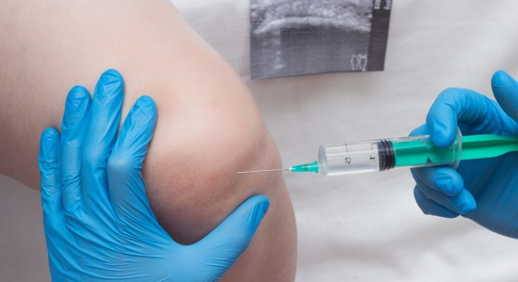 tiêm Corticosteroid cho khớp