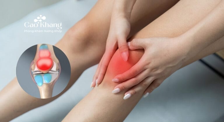 tràn dịch khớp gối có nên xoa bóp không