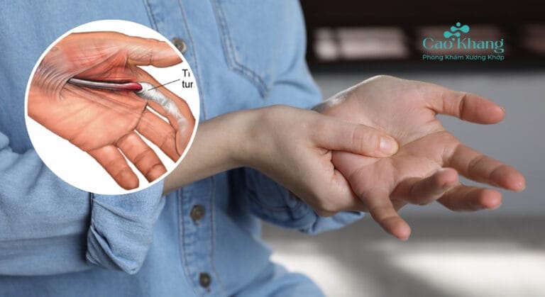 viêm bao gân ngón tay