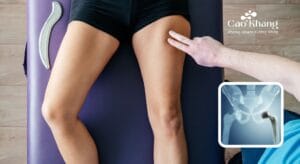 bài tập cho người thay khớp háng