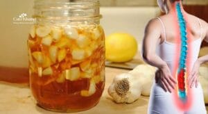 bài thuốc ngâm rượu trị thần kinh toạ