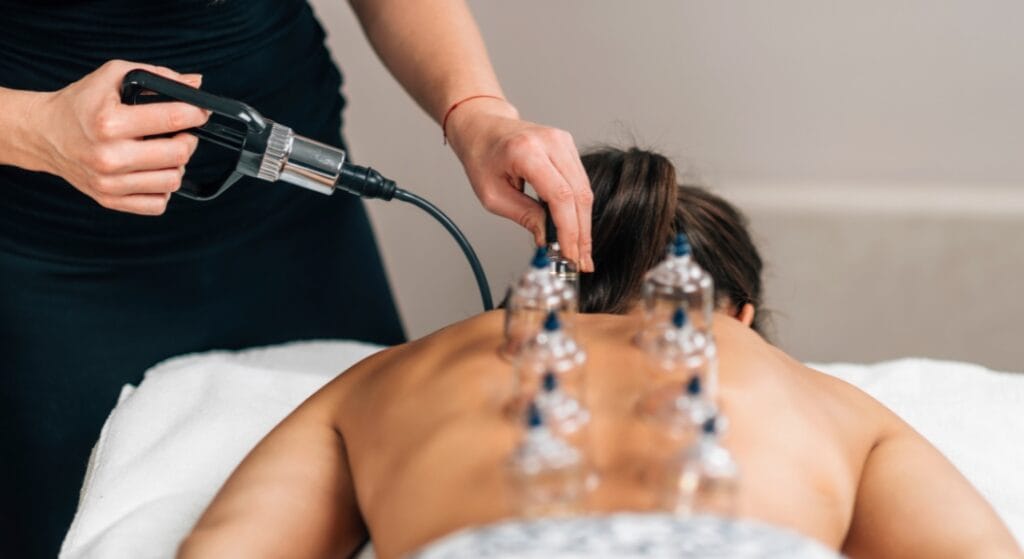 các loại giác hơi