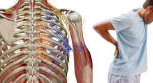 cách chữa đau thần kinh liên sườn