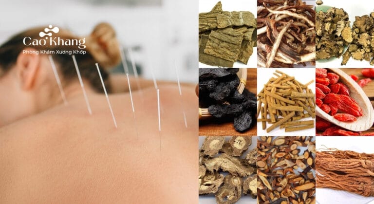 chữa xẹp đốt sống lưng bằng đông y