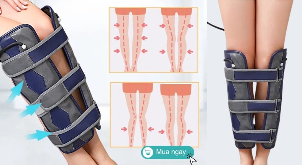 đai chỉnh chân vòng kiềng