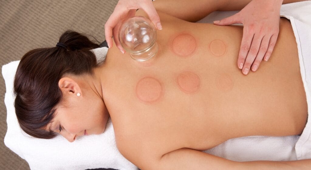 giác hơi có tác dụng gì