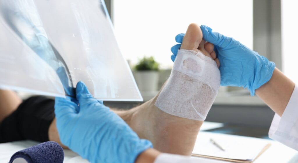 khám đau lòng bàn chân