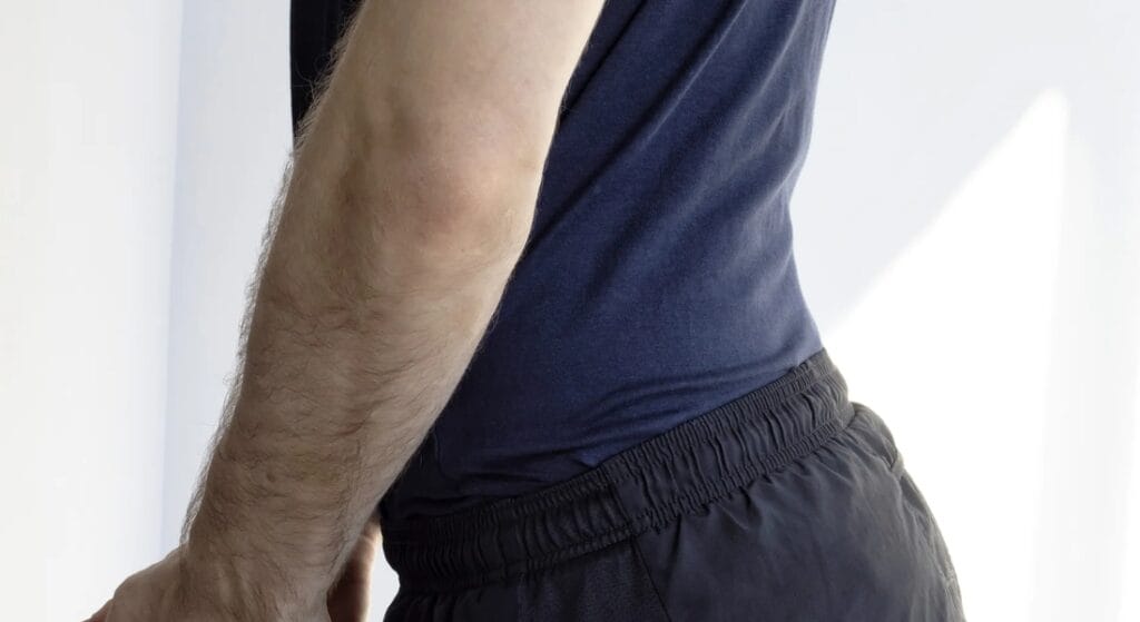 nguyên nhân bị võng lưng