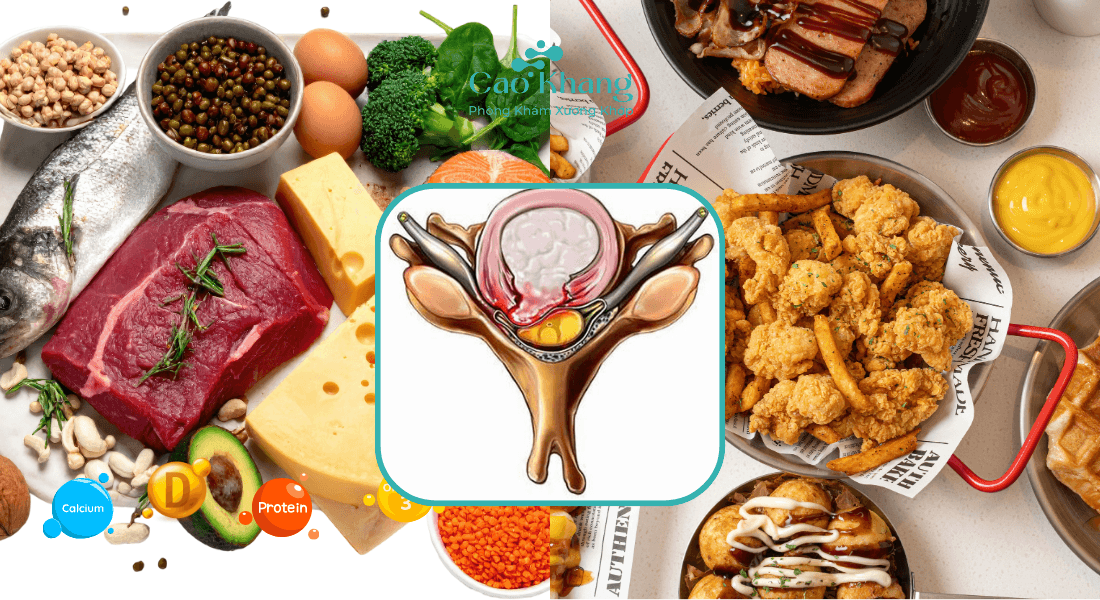 bị phồng đĩa đệm nên ăn gì