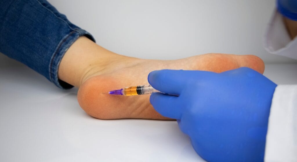 tiêm gai gót chân