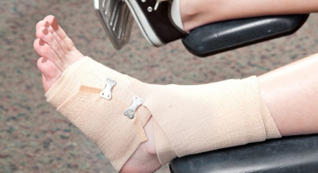 trẹo chân bao lâu thì khỏi