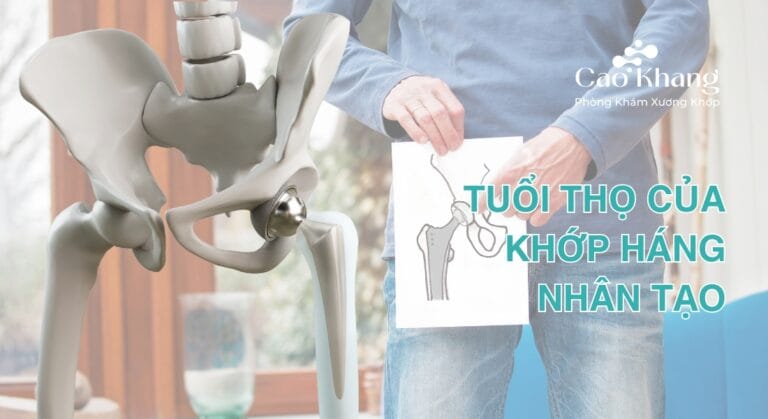 tuổi thọ của khớp háng nhân tạo