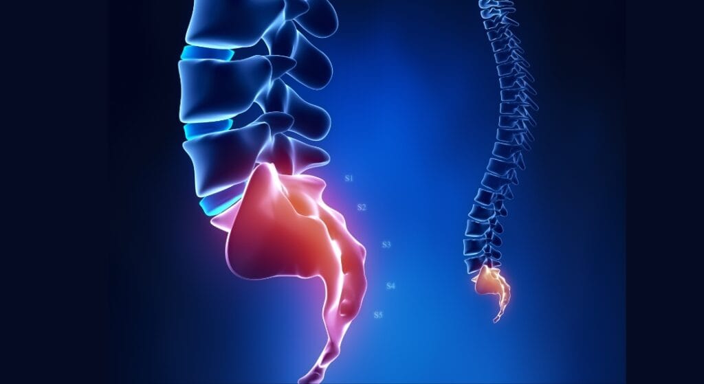 xương cụt bị nhô ra (1)