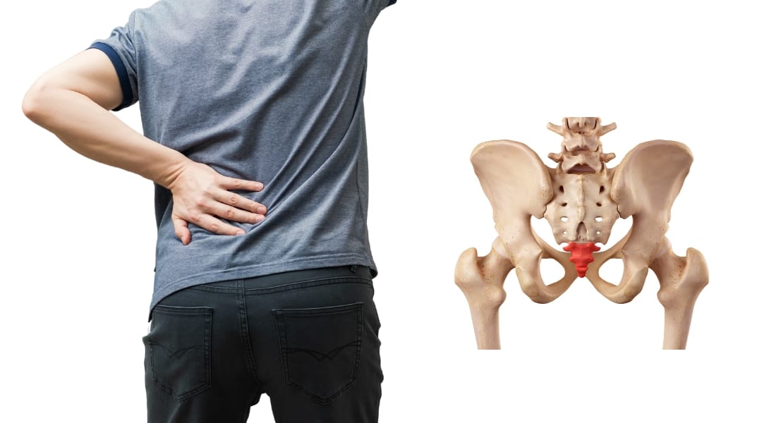 xương cụt bị nhô ra