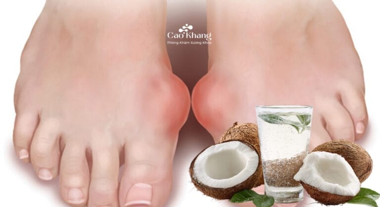 Bệnh gút có uống được nước dừa không