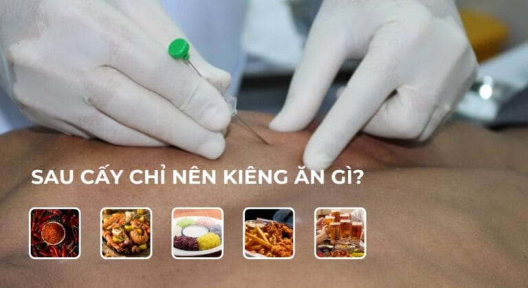 Sau cấy chỉ nên kiêng ăn gì