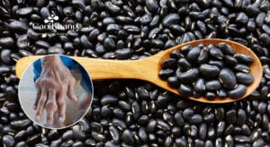 bệnh gút có ăn được đậu đen không