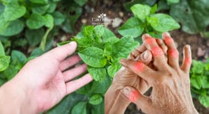 bệnh gút có ăn được rau mồng tơi không