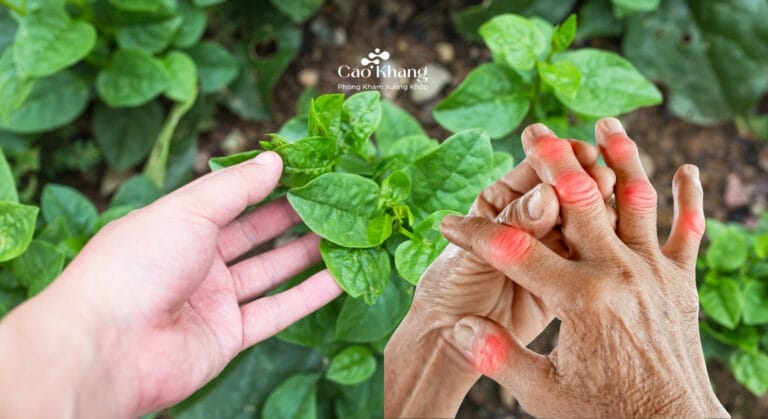 bệnh gút có ăn được rau mồng tơi không