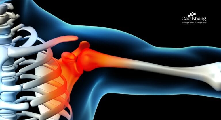 cách chữa đau nhức bả vai