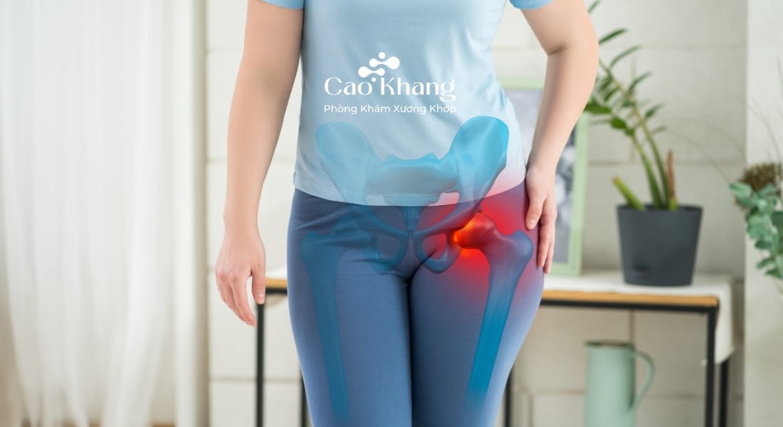đau khớp háng bên trái