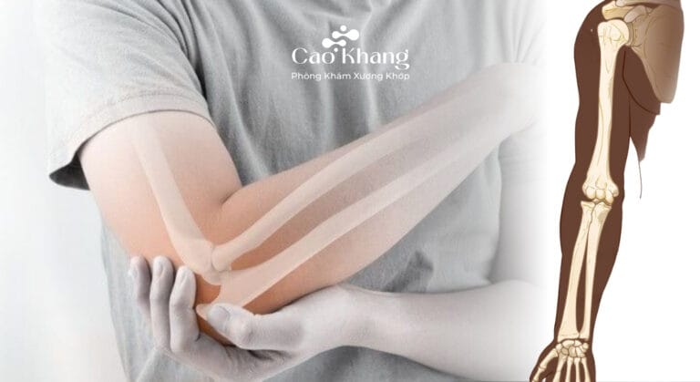 giải phẫu xương cánh tay