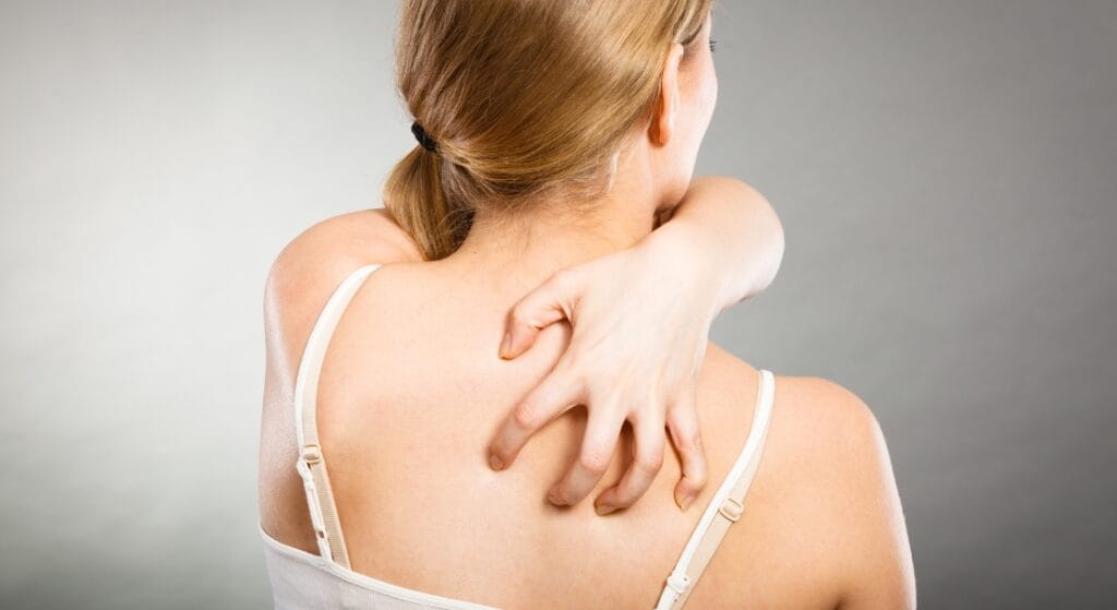 ngứa lưng sau khi cấy chỉ