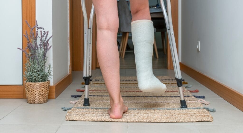 tập đi sau gãy xương chân