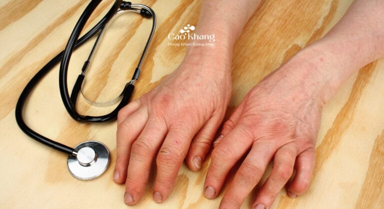 tiêu chuẩn chẩn đoán viêm khớp dạng thấp