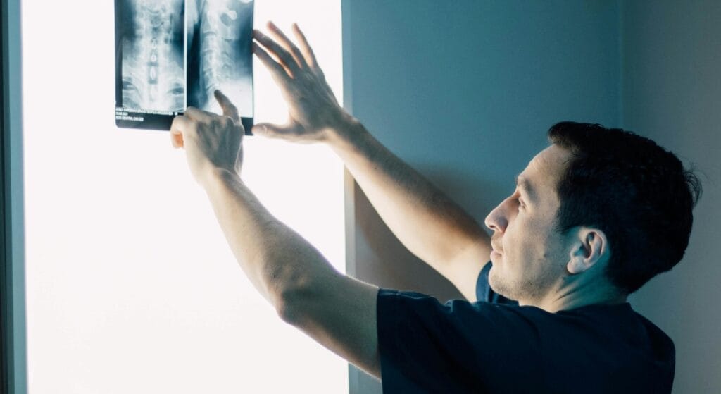 x quang rách vòng sơ đĩa đệm